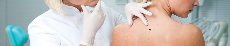 Удаление папиллом на Шоссе Энтузиастов